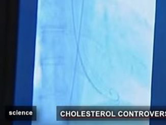Le statine non è che facciano poi così bene alla salute Lo dice uno studio pubblicato dalla rivista Journal of General Internal Medicine