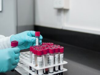 Scoperto nuovo gruppo sanguigno rarissimo: si chiama MAL