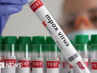 Vaiolo scimmie: Oms approva primo test Mpox per uso emergenza