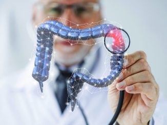 Nuova frontiera nella lotta al tumore del colon
