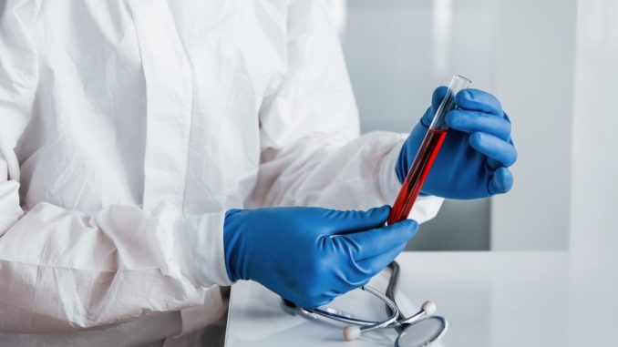 Nuove scoperte amiloidosi cardiache migliorano diagnosi e trattame