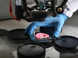 Biostampante evita la rimozione di colon e retto
