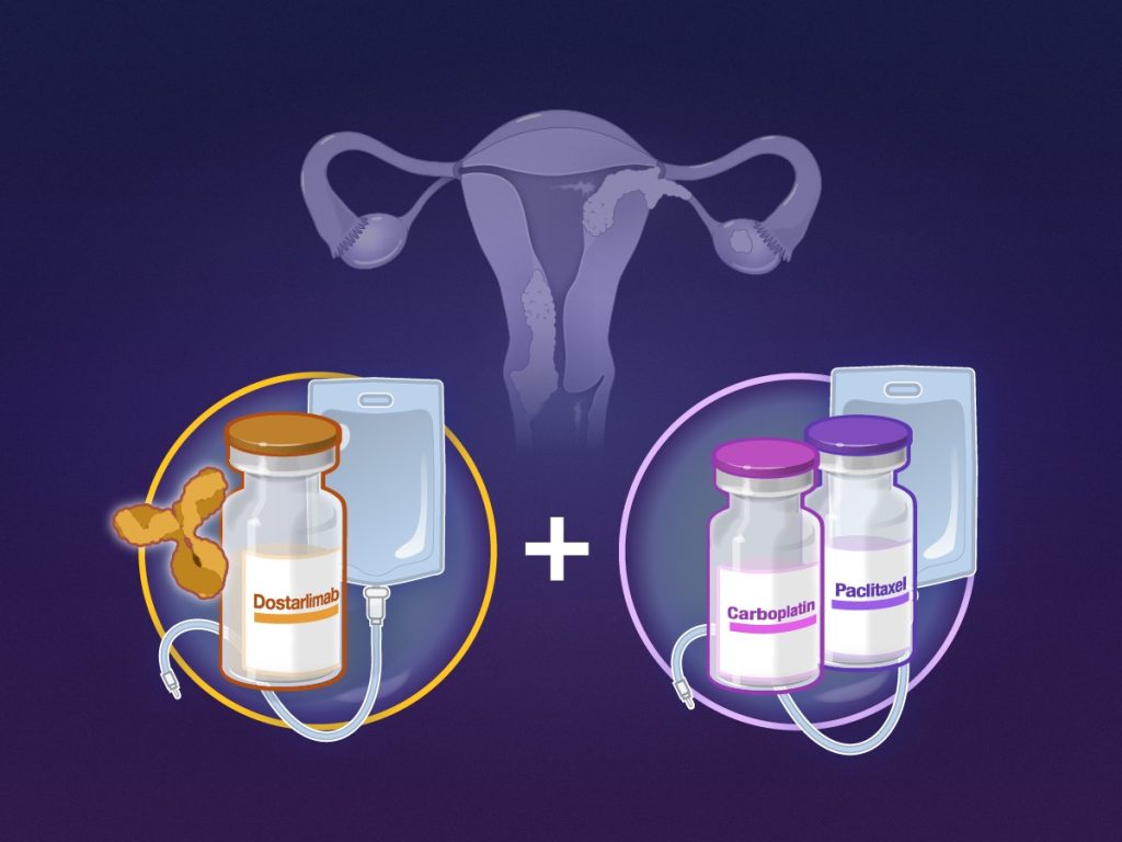 Dostarlimab, svolta Ue per tumore endometrio
