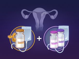 Dostarlimab, svolta Ue per tumore endometrio