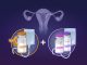Dostarlimab, svolta Ue per tumore endometrio