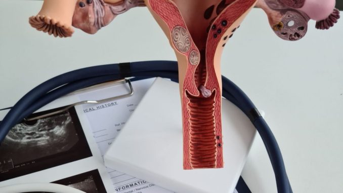 Tumore cervice uterina: bassa copertura vaccinale in Italia
