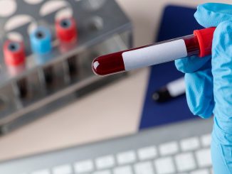 Esame del sangue per la diagnosi precoce del tumore al pancreas