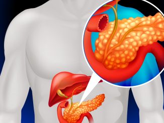 Scoperta la causa dell'aggressività del tumore pancreas