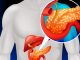 Scoperta la causa dell'aggressività del tumore pancreas