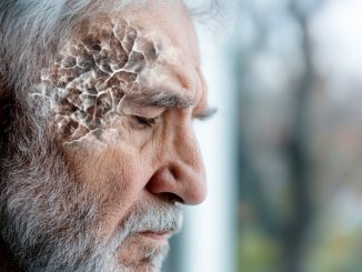 Ictus, prime linee guida su neglect e afasia in Italia