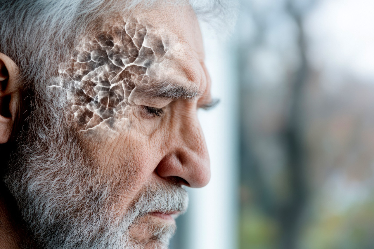 Ictus, prime linee guida su neglect e afasia in Italia