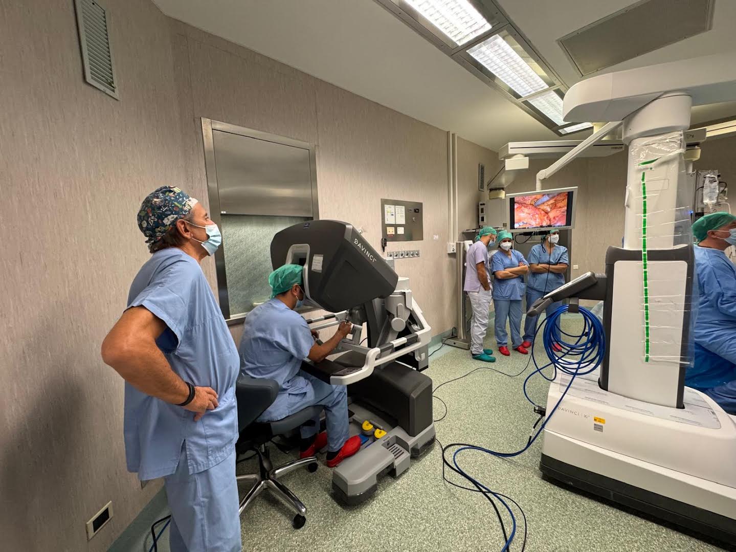Oggi al Presidio Ospedaliero Sacco si è svolto il primo intervento con il sistema robotico Da Vinci Xi, appena installato. Questo evento segna un importante avanzamento nella chirurgia mini-invasiva dell’ASST Fatebenefratelli Sacco.

Il sistema Da Vinci, che aveva esordito proprio al Sacco nel 2004 con la prima prostatectomia radicale robotica italiana, torna con la tecnologia più evoluta. L’intervento odierno, una prostatectomia per carcinoma, è stato eseguito dall’equipe di Urologia aziendale, sotto la guida esperta del dottor Franco Gaboardi, pioniere della chirurgia robotica e ora tutor del team.

Da Vinci Xi consente ai chirurghi di operare da una console, traducendo in movimenti precisi quelli delle mani attraverso braccia robotiche articolate, offrendo una visuale tridimensionale e migliorando la flessibilità operatoria. Questa tecnologia permette di ridurre il trauma chirurgico, abbreviare la degenza e velocizzare il recupero post-operatorio, rappresentando un salto di qualità rispetto alla laparoscopia tradizionale.

L’unità robotica, che sarà a disposizione di varie discipline chirurgiche dell’ASST – tra cui Chirurgia Generale, Pediatrica, Urologia, Ginecologia e Otorinolaringoiatria – sarà gestita da un Team Robotico dedicato per ottimizzare l’uso condiviso della sala operatoria.

La Direttrice Generale Maria Grazia Colombo ha sottolineato come questa novità sancisca l’ingresso ufficiale del Sacco in un’epoca moderna di chirurgia robotica, sottolineando il valore del lavoro delle équipe mediche nella continua innovazione per garantire cure più efficaci e personalizzate ai pazienti. L’introduzione del Da Vinci Xi testimonia la spinta dell’ASST verso un’eccellenza clinica che unisce tecnologia all’attenzione per la salute delle persone.
