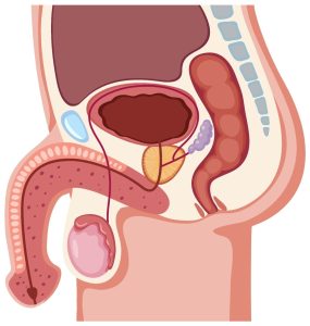 Nuova terapia per La Peyronie, svolta nella fase acuta