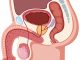 Nuova terapia per La Peyronie, svolta nella fase acuta