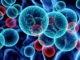 Terapia CAR-T contro leucemia linfoblastica acuta arriva anche in Europa