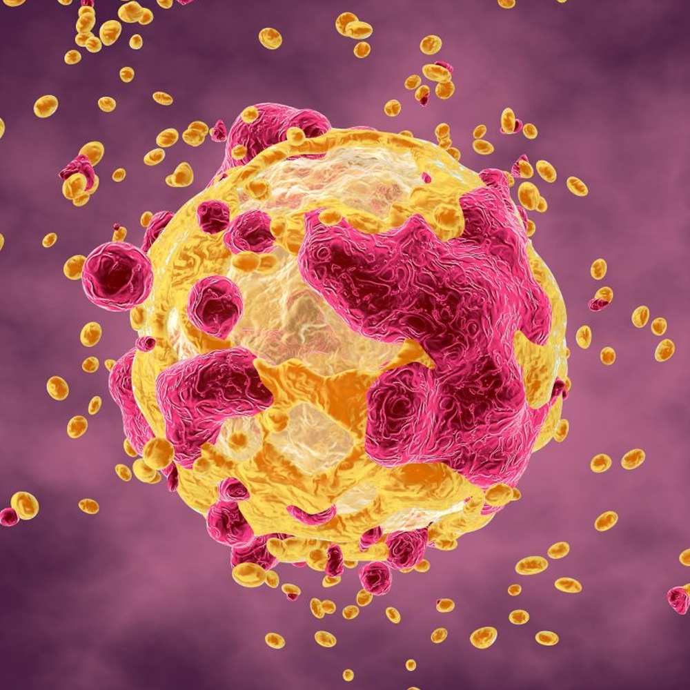 Tumori in forte crescita: 30 milioni di nuovi casi entro 2050