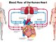 Trisol medical rivoluziona il cuore: test positivi negli USA