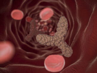 Studio NO-CUT, la biopsia liquida rivoluziona la cura del tumore rettale